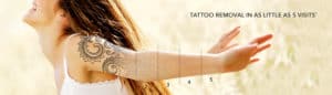 tattoo removal banner image