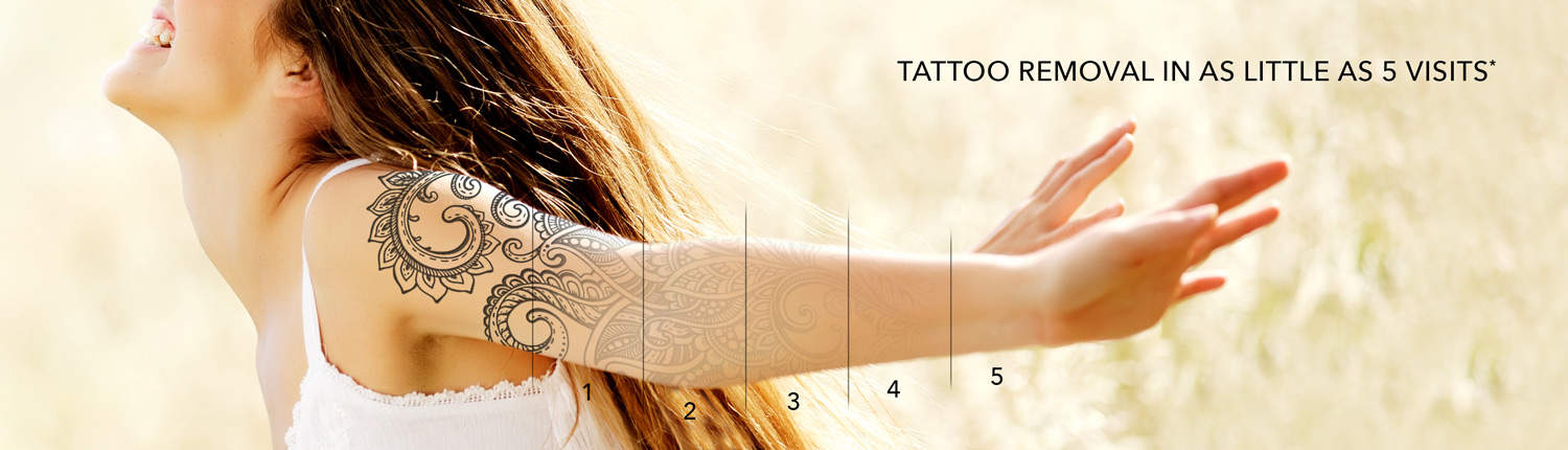 Tattoo Removal Treatment in Montreal | Victoria Park Medispa - Montreal