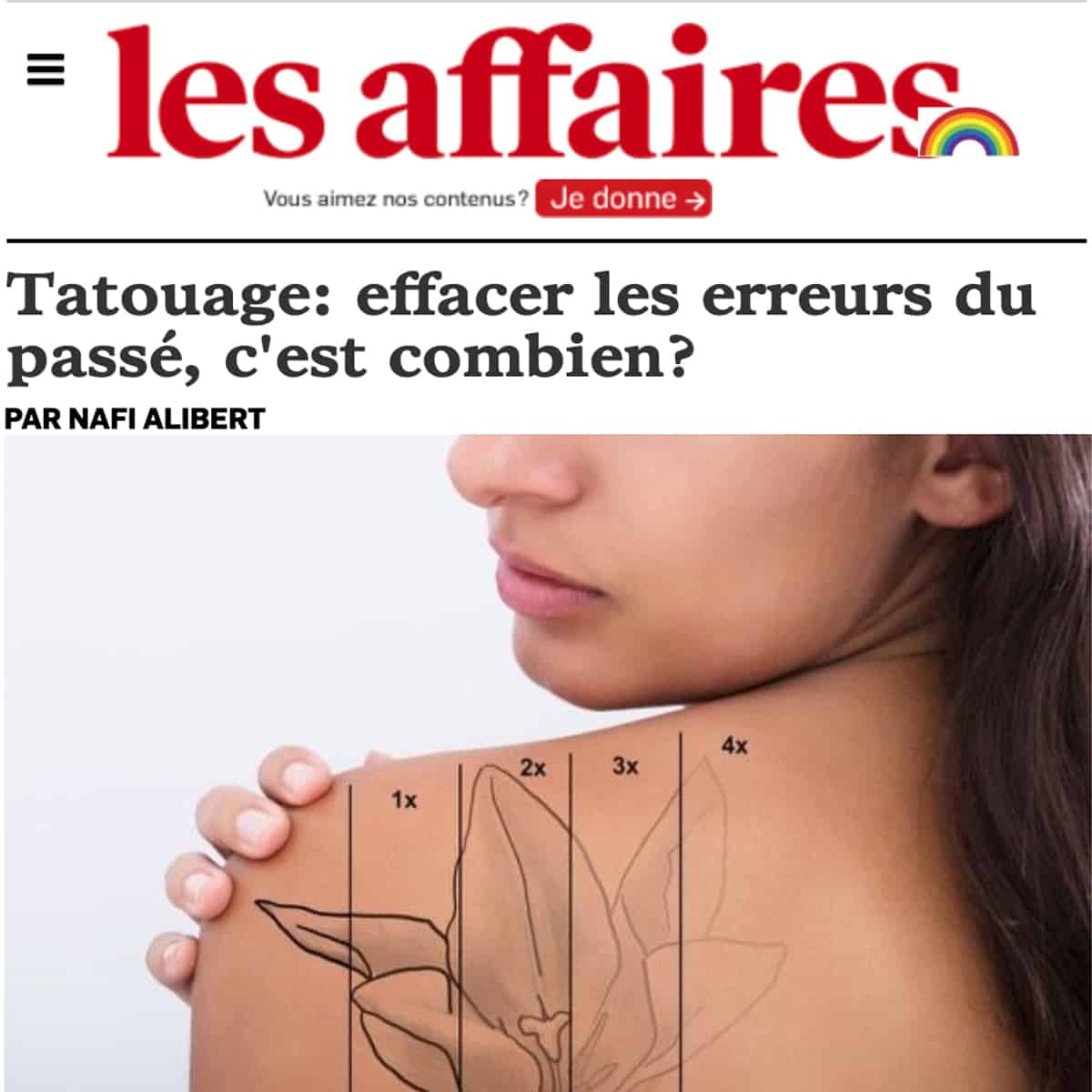 Les Affaires - Tattoo Removal | Victoria Park Medispa-Montreal