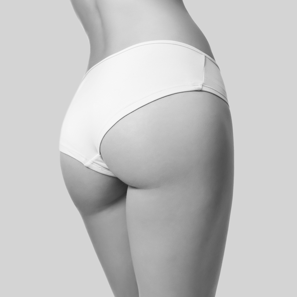 Liposuction treatments such as CoolSculpting, Emsculpt and Exilis are used to reduce the fat around buttocks.
