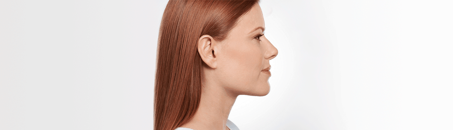 Belkyra injections for double-chin