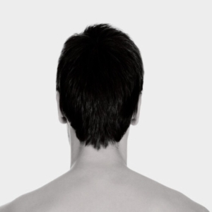 Nape (Back of the head) laser hair removal for men at Victoria Park Medispa.