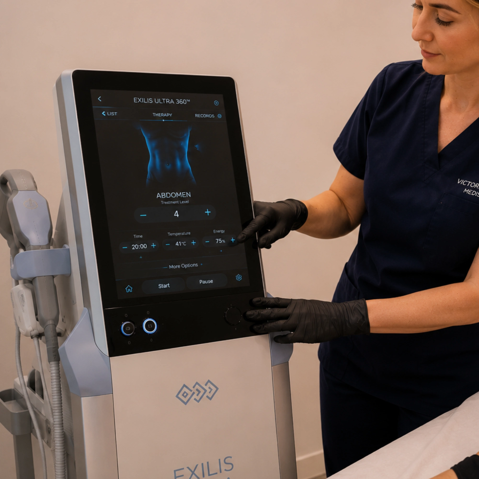 Exilis Ultra 360 treatment settings for non-surgical abdominal skin tightening and body contouring.