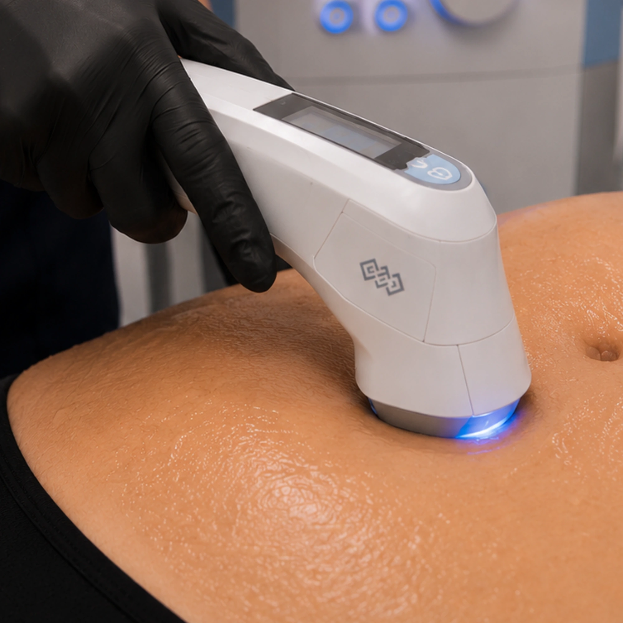 Close-up of Exilis Ultra abdominal skin tightening treatment for firmer, smoother-looking skin.