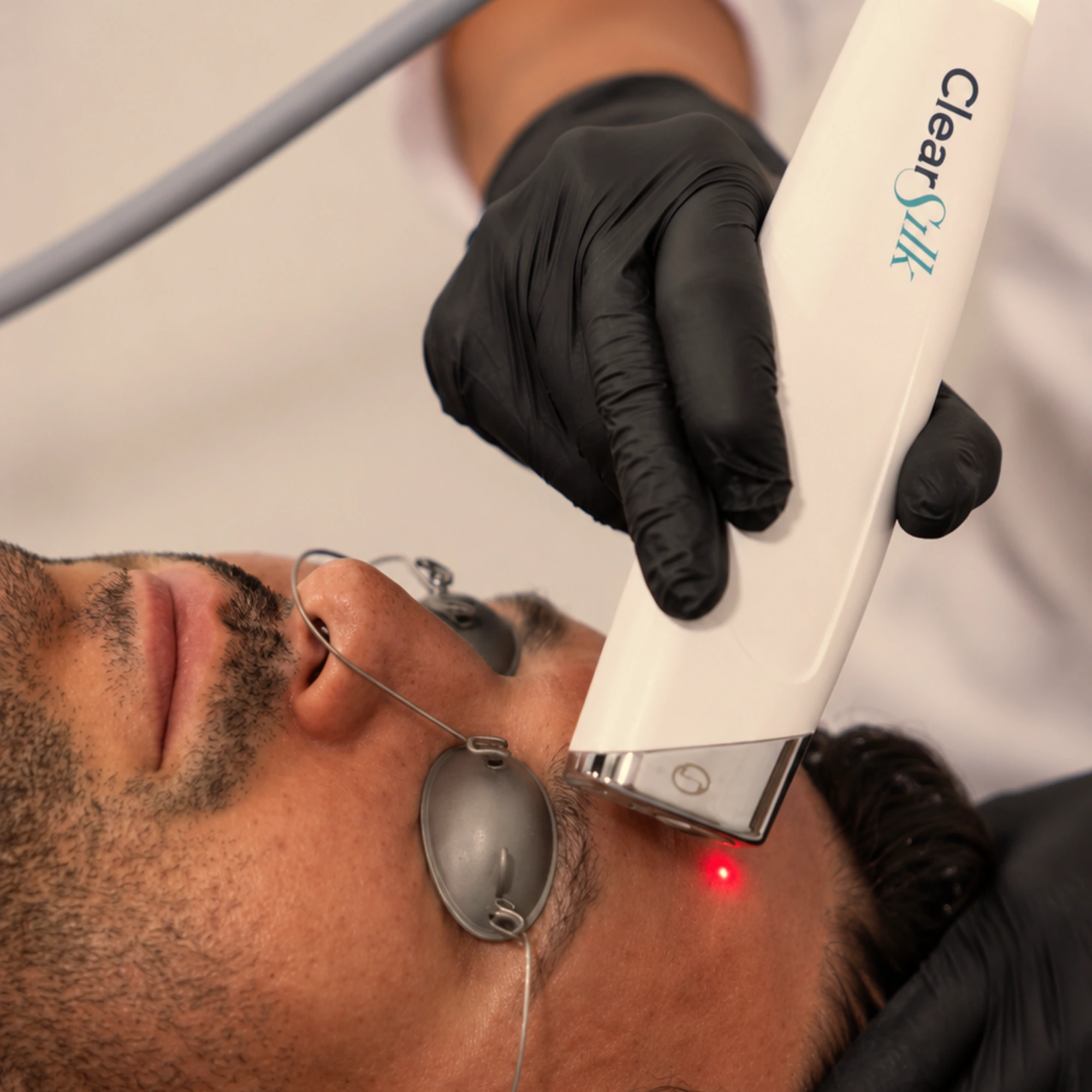ClearSilk™ laser treatment performed on a man's forehead in a medical aesthetics clinic. The patient wears metal protective eye shields while the provider, wearing black gloves, applies the ClearSilk™ laser handpiece to gently rejuvenate the skin and improve overall skin quality.